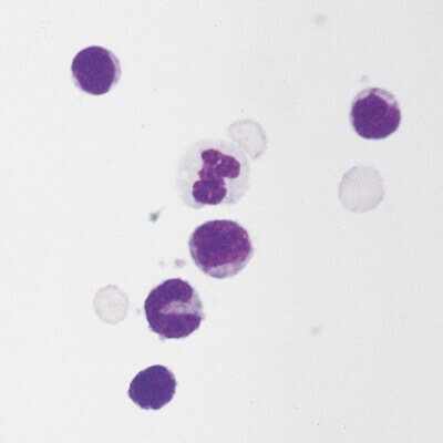 Cells on Microscope Slide (Buffy Coat)